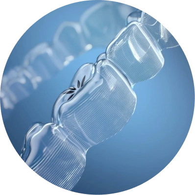 What are the main benefits of clear aligners compared to traditional braces?