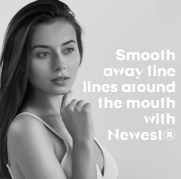Smooth lines around the mouth