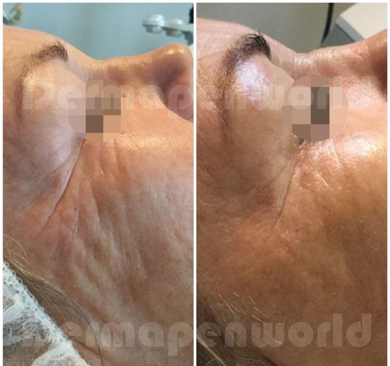 Treatment before and after 