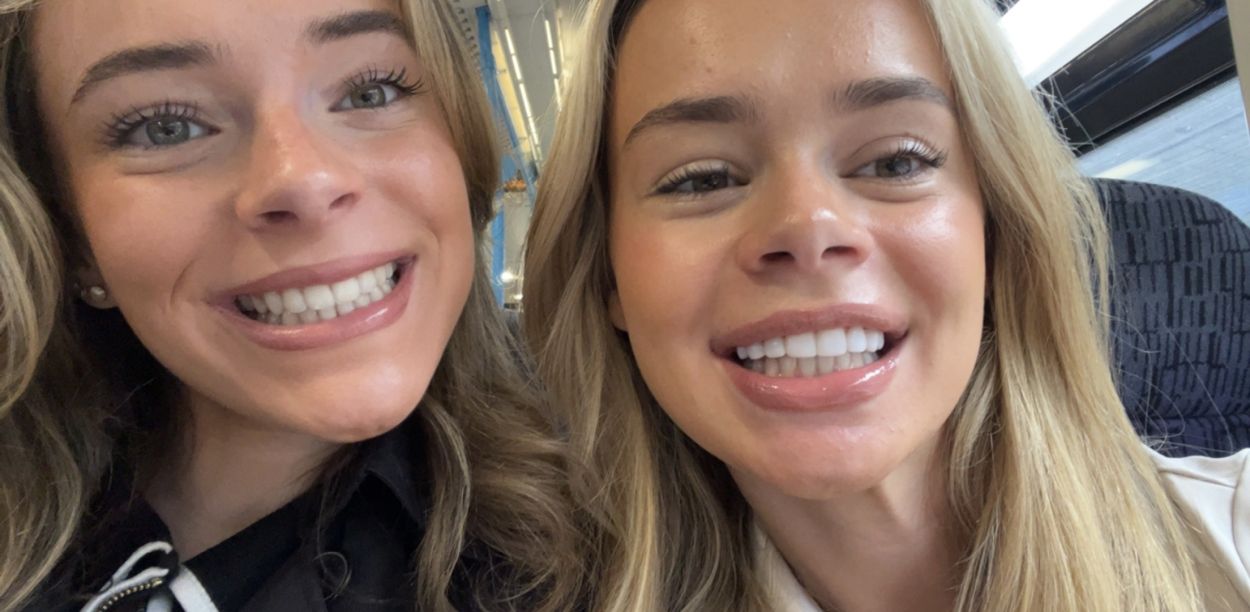 Invisalign Casestudy